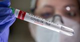 Nearly 1 in 5 adults who had COVID have lingering symptoms – U.S. study