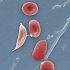DVIDS – News – U.S. Army medical officer passes demanding American Board of Medical Microbiology exam