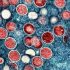 Biden administration will declare monkeypox a public health emergency