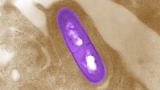 CDC investigating new Listeria outbreak nationwide, 12 cases in Florida