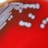 About 1 in 20 COVID-19 Patients Will Develop Long-Term Loss of Smell, Taste – Consumer Health News