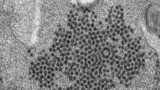 Expected surge in virus that can paralyze kids didn’t happen, baffling experts