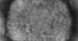 Michigan confirms 9 monkeypox cases, CDC says