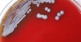 Bacteria found along Gulf Coast could cause rare disease