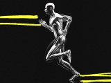 Is arthritis musculoskeletal? Definition, types, and risk factors