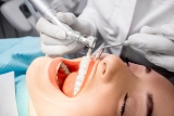Do You Need to Brush Your Teeth Before Going to the Dentist?