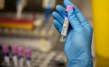 Quest launches monkeypox PCR test as U.S. attempts to catch up with rising cases