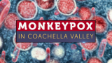 Monkeypox cases rise to 51 in Riverside County, 9 new cases in Coachella Valley