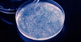 New drug candidate may fight off 200+ antibiotic-resistant bacteria