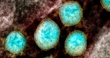 COVID-19 cases are spiking in the U.S., CDC warns
