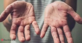 BiH confirms first monkeypox case, Health News, ET HealthWorld