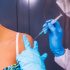 Repeating COVID mistakes gives US world’s biggest monkeypox outbreak