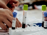 Blood test highly accurate in large, international study