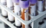 CDC: 58% of Americans have had COVID-19