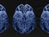 How brain immune cells can slow down progression