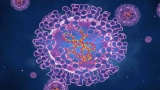 Monkeypox: What are the symptoms, how does it spread, and how worried should we be?
