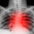 11 new COVID deaths in Utah since Thursday & 261 new positive cases; CDC says no mask mandates in Utah – Cache Valley Daily