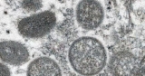 Maryland health officials are restricting access to the monkeypox vaccine