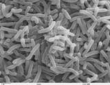 Spike in cholera in Cameroon kills 29 in one week