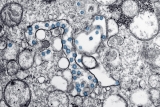 Chronic COVID infections source of variants of concern, study shows