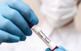Vaccine remains in short supply as US monkeypox cases grow
