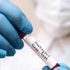 Monkeypox likely to be around for ‘many months’ but vaccine strategy working: Ontario’s top doctor