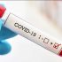 Another four children die of Strep A as UK’s death toll hits 30 