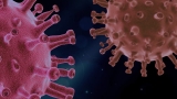 Can Covid-19 Increase The Chances Of Having A Stroke?