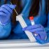Long COVID played a role in thousands of deaths: CDC