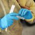 Lassa Fever – Nigeria