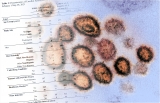 CDC study on efficacy of mRNA vaccines against symptomatic COVID-19