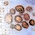 5 Tips for a Healthier Gut Microbiome with Type 2 Diabetes