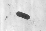 CDC probes listeria cases in NY, NJ; some linked to meat from NYC delis