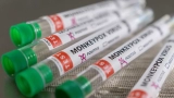 NSW Health confirms first local transmission of monkeypox in the state