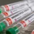 DR Congo investigates suspected Ebola case