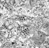 Sudanese officials say Dengue fever outbreak kills 26
