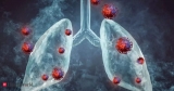 Different strains of tuberculosis can attack lungs, finds study, Health News, ET HealthWorld