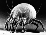Could dust mite extract help?