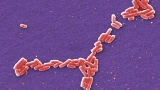 ‘Fast-moving’ E. coli outbreak in Ohio, Michigan