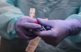 Sangamon County reported 700 additional COVID-19 cases this week