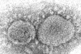 New Omicron subvariant makes up nearly a third of cases