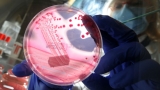 More illnesses reported in E. coli outbreak, CDC says