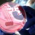 Moderna sues Pfizer/BioNTech for patent infringement over Covid vaccine