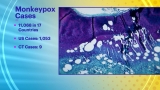 9 monkeypox cases identified in Connecticut