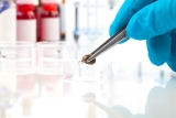 Pfizer, Valneva Initiate Phase 3 Study for Investigational Lyme Disease Vaccine Candidate