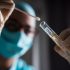 Suspected case of monkeypox detected in N.B., says health minister
