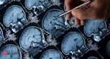 Facing up to the Alzheimer’s crisis, Health News, ET HealthWorld