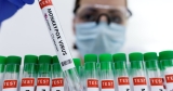 FACTBOX-Monkeypox cases around the world – Reuters News