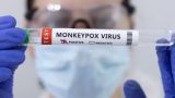 Monkeypox information in the works for N.B. clinicians, citizens, says health official