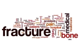 How Women Can Reduce The Risk Of Hip Fracture
